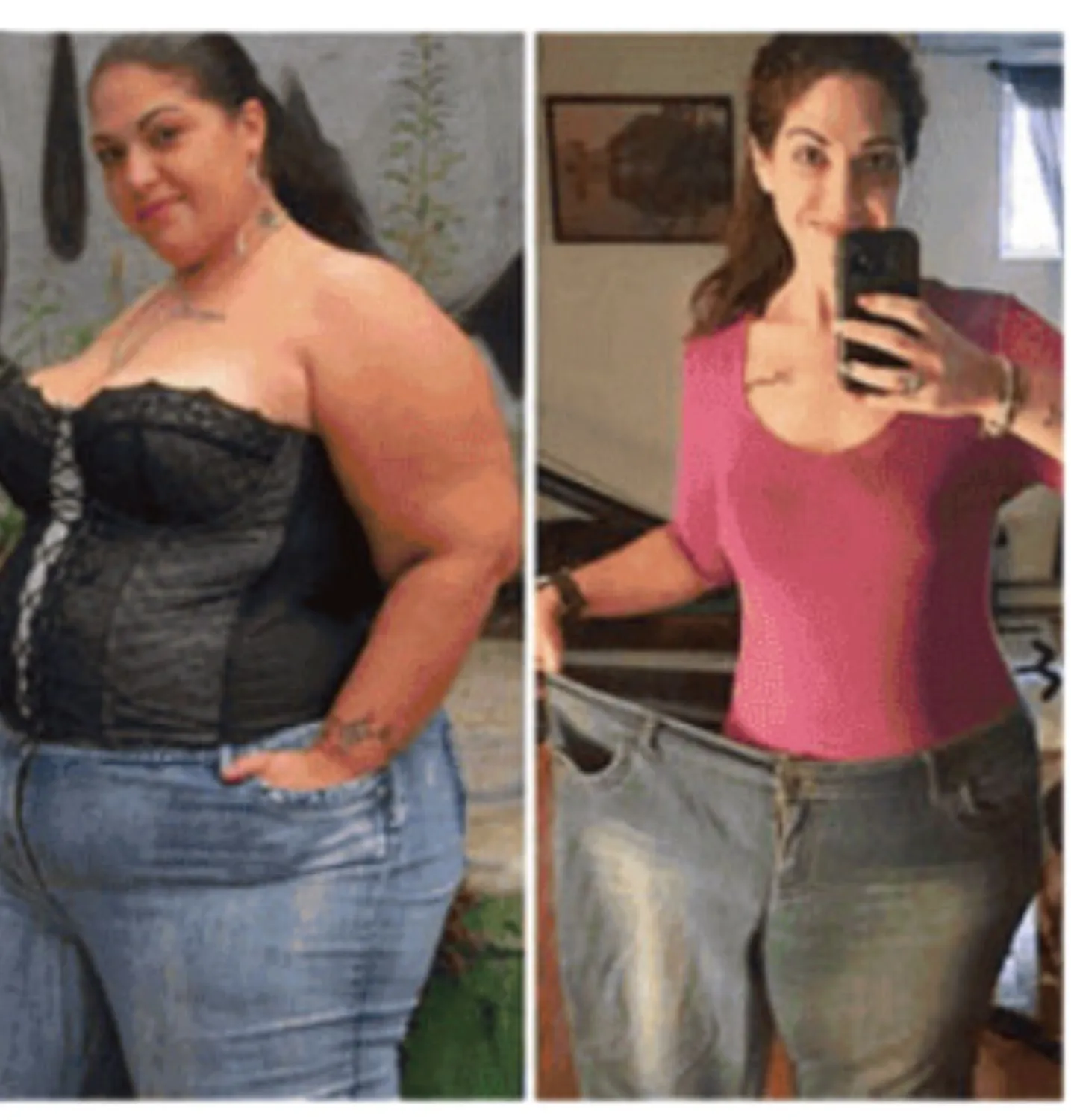 Antes e depois Ozemp Sole 1