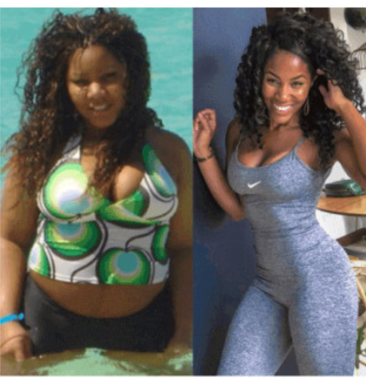 Antes e depois Ozemp Sole 2