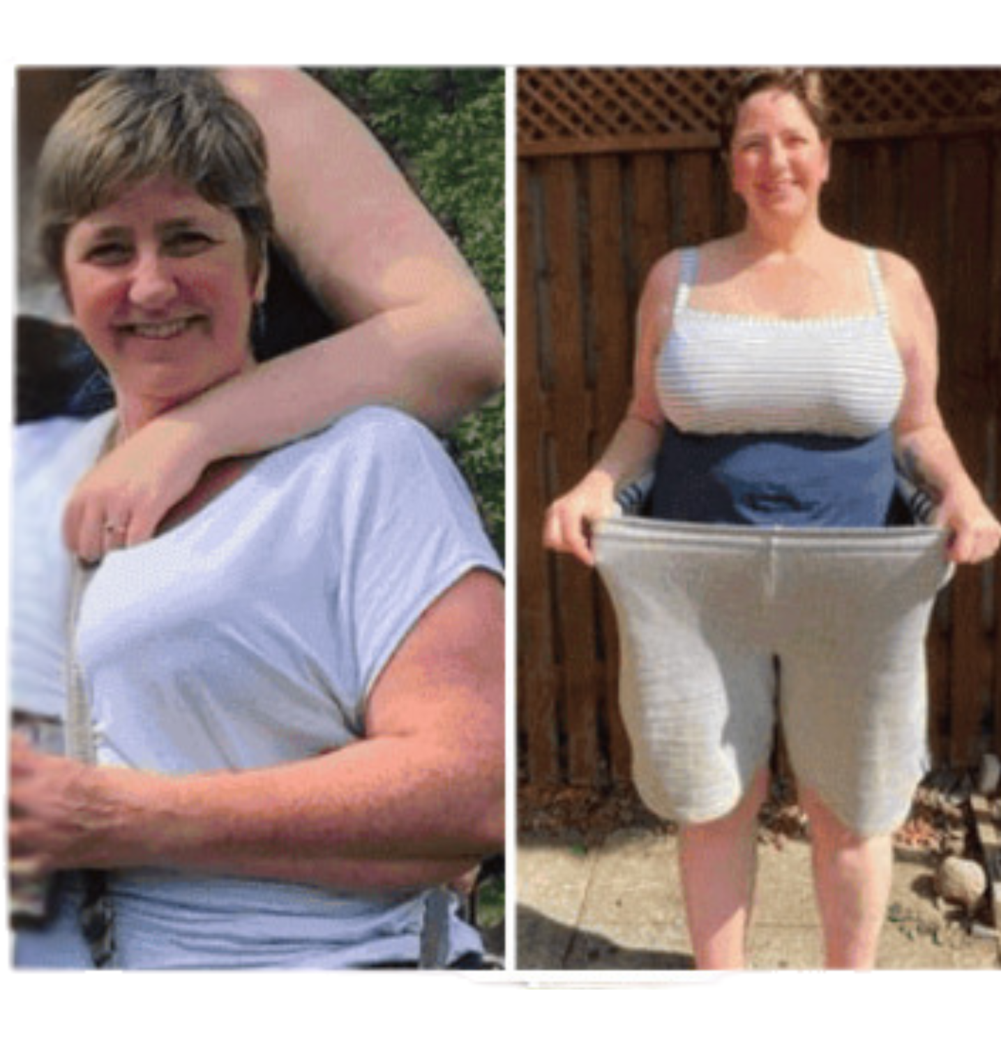 Antes e depois Ozemp Sole 3