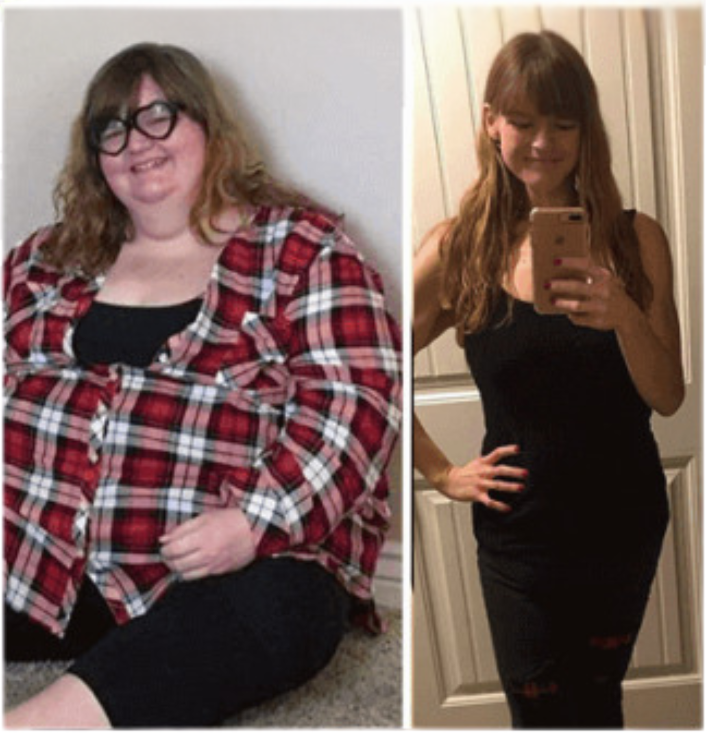 Antes e depois Ozemp Sole 4